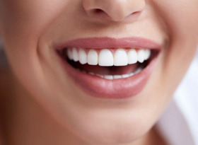 чистка зуб отбеливание стоматология