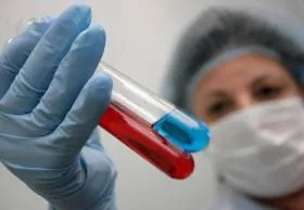 Нашли средство защиты от ВИЧ исследователи