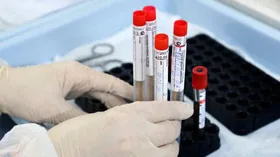 Поможет купировать передачу COVID-19 изменение физических свойств слюны